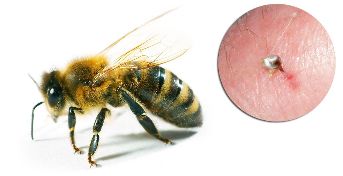 Dans la Composition Hondrostrong le Venin d'abeille inclus, améliore les processus Métaboliques dans les Tissus